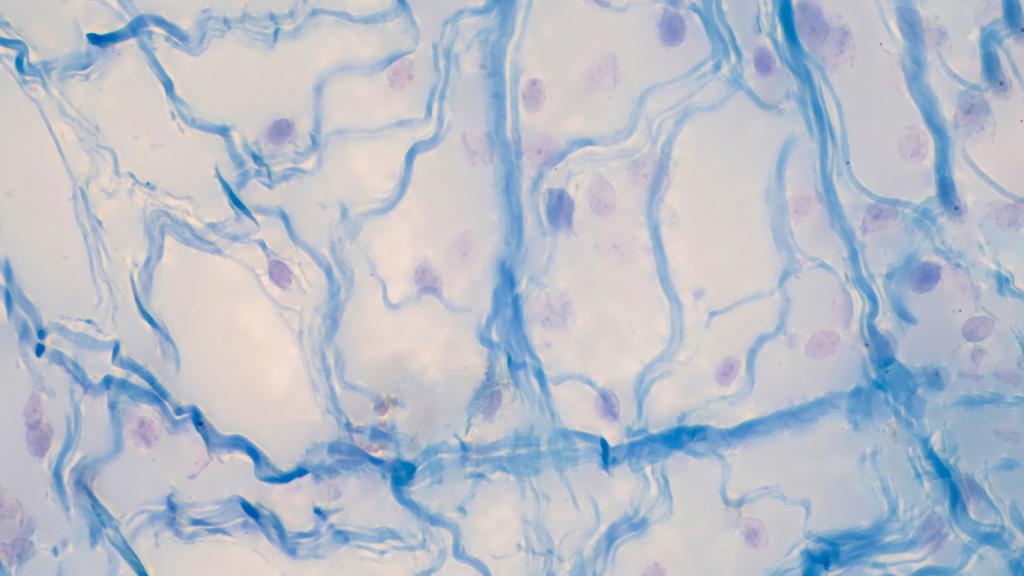 The Unexpected Connection Between Estrogen and Autism | SciShow News