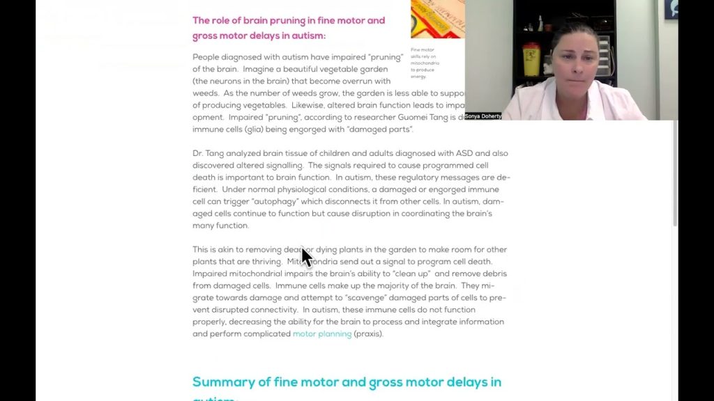 Fine and Gross Motor delays in Autism