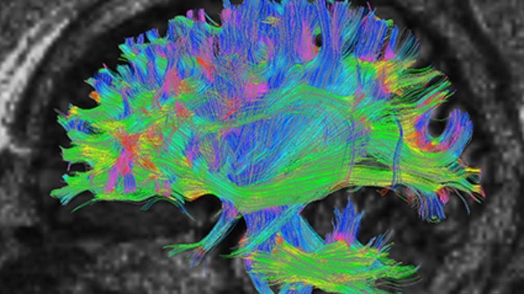 New AI System Can Accurately Diagnose Autism Spectrum Disorder in Early Childhood, New Study Shows