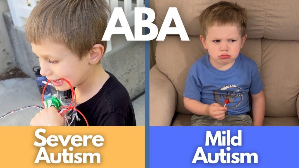 “Real-Life ABA Therapy: Supporting Mild and Severe Autism at Home”