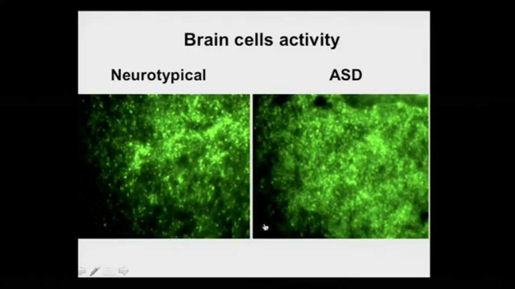 Stem Cells & Autism: Cracking the Genetic Code in a Petri Dish!