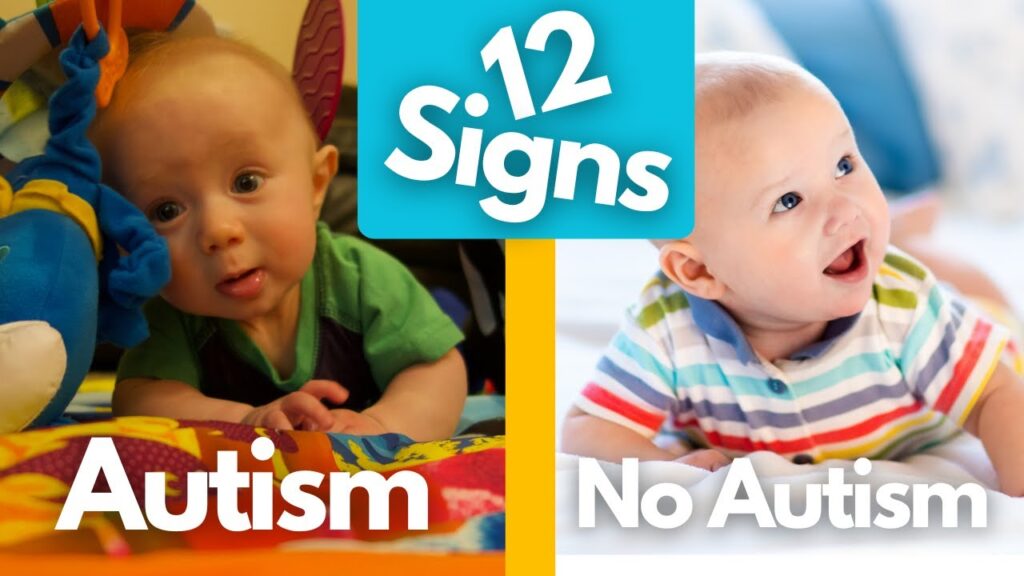 Early Signs of Autism in Infants, You Might Miss