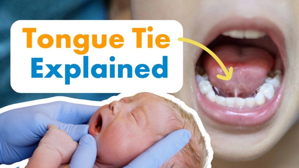Could a Tongue Tie Be Affecting Your Child’s Speech, Feeding & Development?